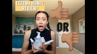 ECZEMA HONEY REVIEW - ARE THESE 6 PRODUCTS WORTH IT?