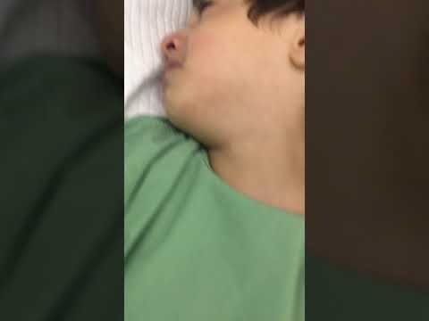 علي صلاح بعد الإفاقة من عملية اللوز و اللحمية والجيوب الأنفية