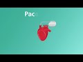 Recognizing a pacemaker infection