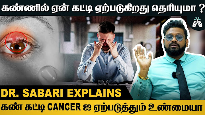 #கண் கட்டி வந்தால் முதலில் இதை செய்யுங்கள் | Dr Sabarinath Ravichandar Explains #stye #eyes