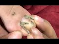 HOW TO CUT THICK TOENAILS - Toenail Cleaning Satisfying #28