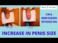 Can Medicines Increase Penis Size ?