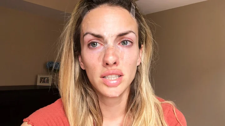 Addressing plastic surgery rumours