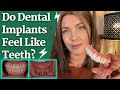 Do dental implants feel like teeth