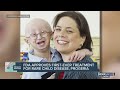 1st Drug For Rare Rapid Aging Disease Extends Kids Lives 1st Drug For Rare Rapid Aging Disease Extends Kids Lives