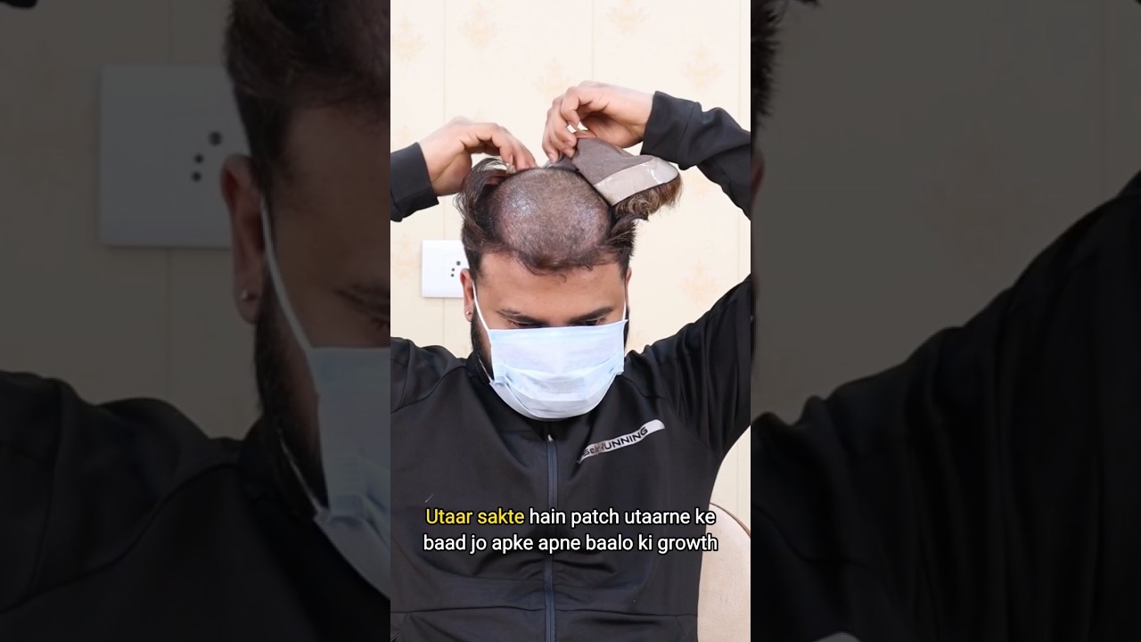 Hair patch service at home| Hair Patch Self Service| Hair Patch Service #hairloss