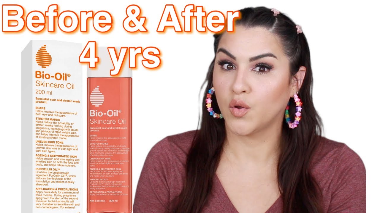 Bio Oil Before & After 4 Years Later