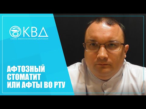 Видео: Являются ли герпетиформные язвы заразными?