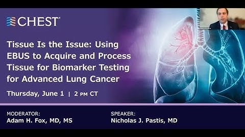 Tissue is the Issue: Using EBUS to Acquire & Process Tissue for Biomarker Testing in Adv Lung Cancer