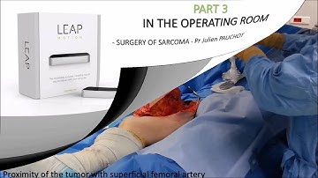 LEAP MOTION IN SURGERY