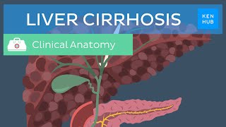 Liver cirrhosis: Definition, pathology, diagnosis, treatment and prevention | Kenhub