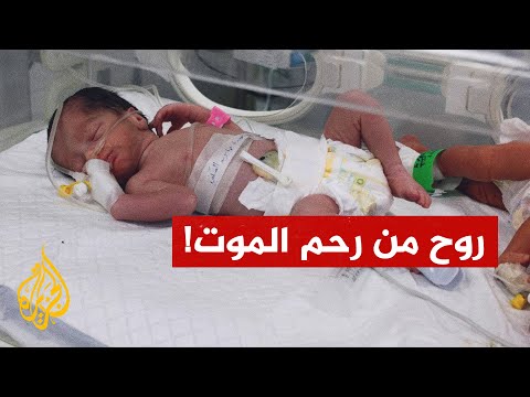 استخراج طفلة من رحم فلسطينية قتلت بغارة في غزة