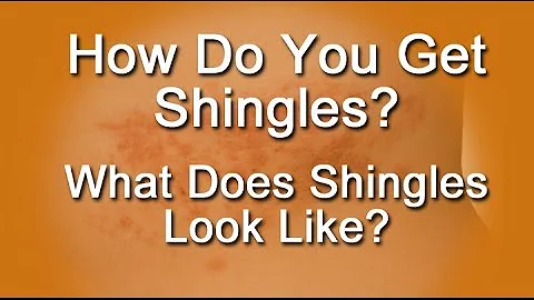 How Do You Get Shingles? What Does Shingles Look Like?