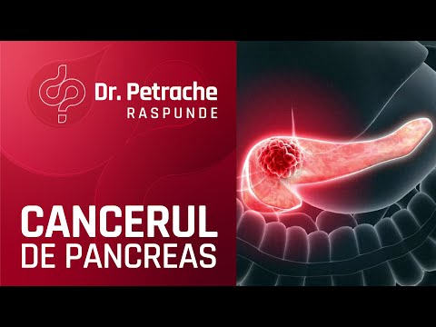 SIMPTOME IN CANCERUL DE PANCREAS