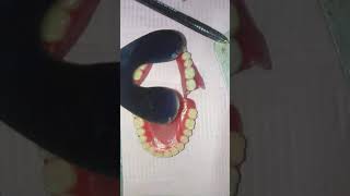 Visit 4: Checking centric occlusion in Try-in