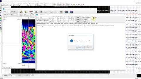 MEG/EEG Time Frequency Analysis 06