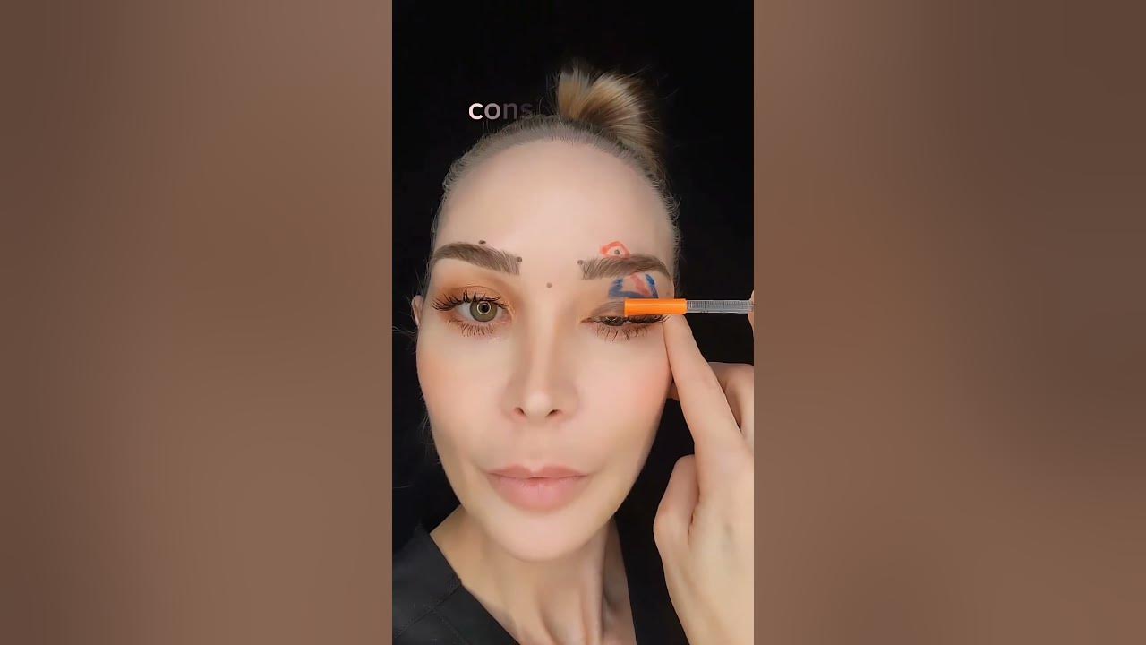 Can Botox Fix A Droopy Eyelid