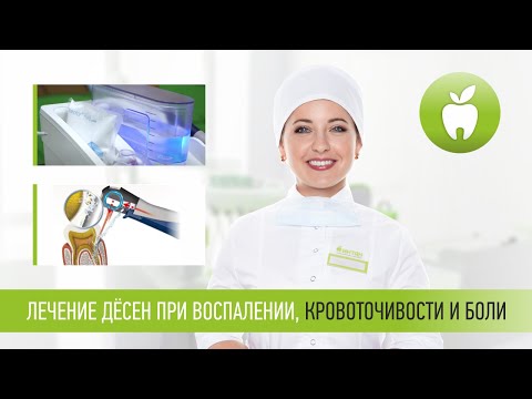 Лечение дёсен при воспалении, кровоточивости и боли