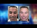 Full Mouth Reconstruction with Las Vegas Prosthodontist Nicole Mackie, DDS