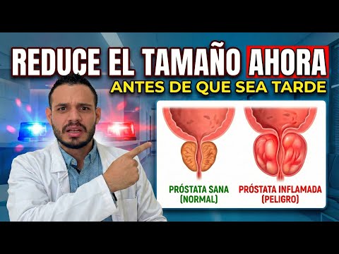 Cómo Reducir el Tamaño de la Próstata Naturalmente (Con y sin Medicamentos)