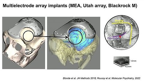 Integrating Single Neurons and Circuits in Stem Cell Derived Neuronal Networks