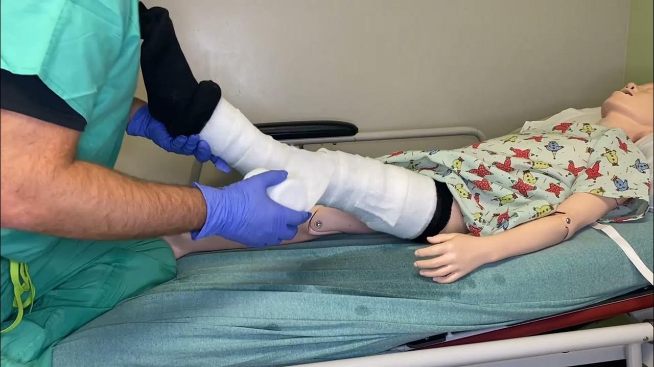 Long Leg Cylinder Cast YouTube