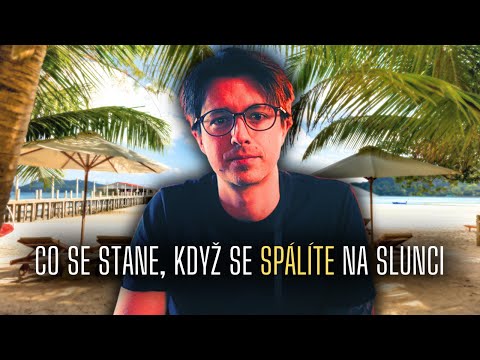 Video: Používají se deštníky na slunce?