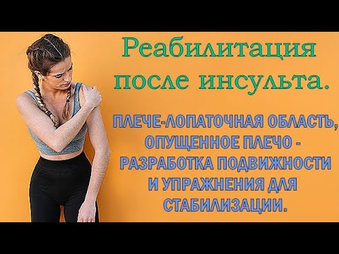 Реабилитация после инсульта. Опущенное плечо, восстановление подвижности плече-лопаточной области.