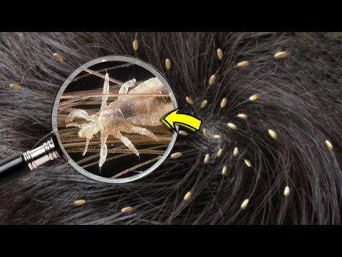 Video: Kıllı Saç Fırçası Nasıl Temizlenir: 14 Adım (Resimlerle)