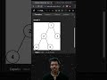 Diameter of Binary Tree: The 1 DFS Pattern You MUST Know