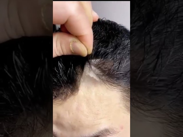 9899746489Natual Hair patch in Delhi #viral #explore #natural #hairpatch #delhi #amazing #look