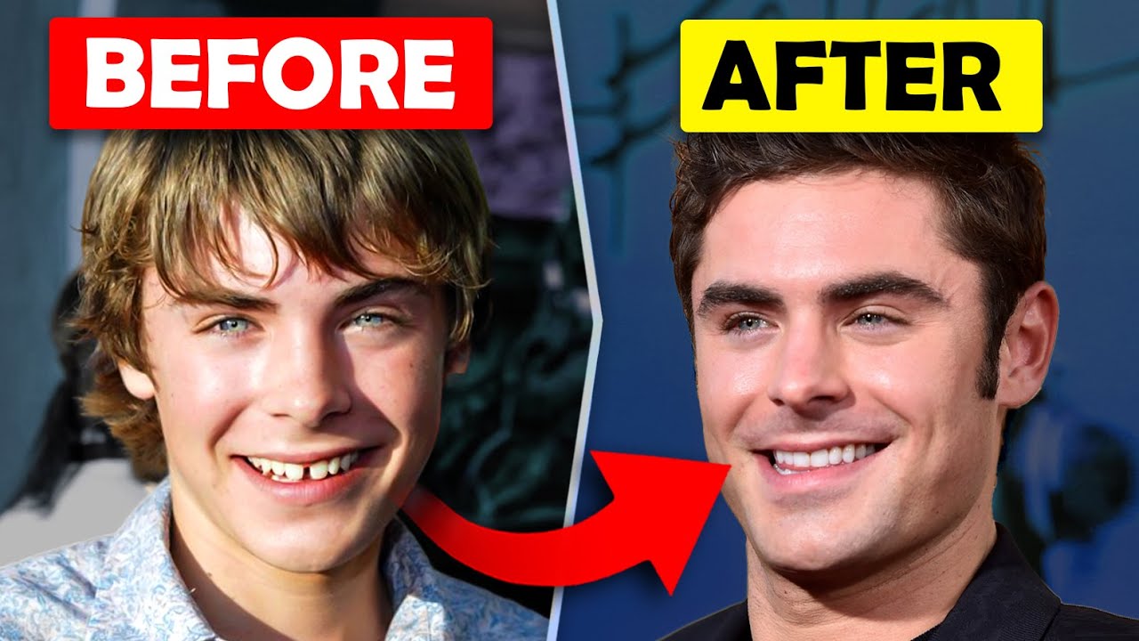 What happened to Zac Efron's teeth?...Orthodontist EXPLAINS - YouTube