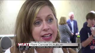 CBS42 Auburn Eye Cancer