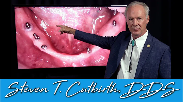 How to Stabilize a Loose Denture - Dental Minute with Steven T. Cutbirth, DDS