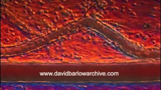 Inflammatory Response in Tissue 1