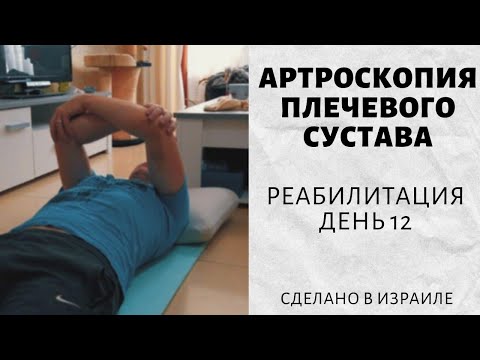 Артроскопия плечевого сустава | 12 дней после операции | Реабилитация