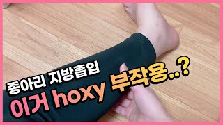 종아리 지방흡입 두 달차 후기!💦 l 하체비만 l 지방흡입 후기 l 지방흡입 부작용