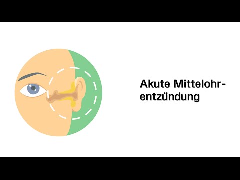 Akute Mittelohrentzündung -
