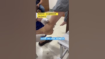 Ankle sprain Test | Ankle Ligament injury | Best Foot and Ankle surgeon In india .