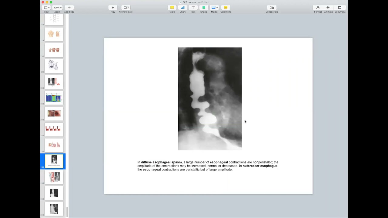 Esophagus - General Surgery Course (4th + 6th Stages)
