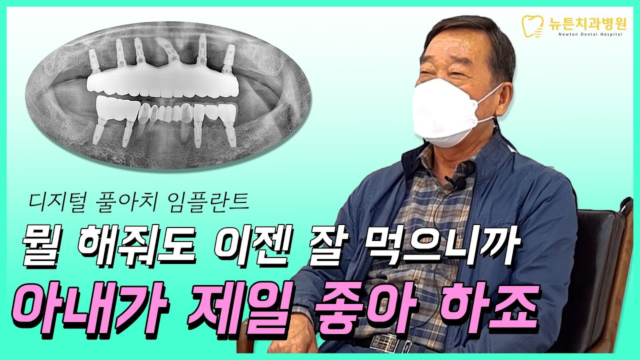 네비게이션 가이드를 이용한 임플란트 후기