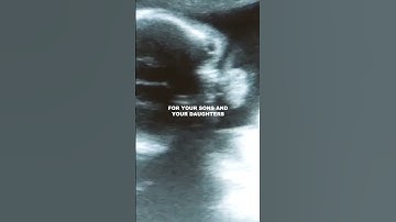 Thumbnail of *Sees Pregnancy Test* 😭
