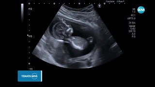 Темата На Nova Клетка По Клетка Живот 15.03.2025