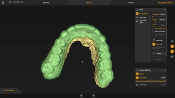 Primeprint Solution Workflow para crear una férula CEREC