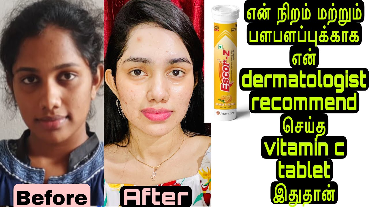 How To Use Vitamin C Tablets For Skin Whitening Im using this vitamin c tablet for my skin whitening and glow - YouTube