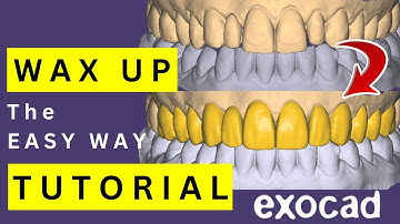 BIG Case Aesthetic WAX UP. 2025 EXOCAD