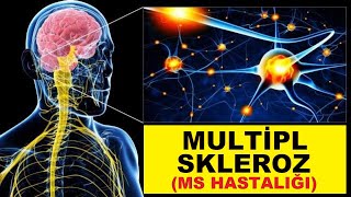 Dr  Berg, Multipl Sklerozun (MS Hastalığı)  Nasıl Tedavi Edileceğini Açıklıyor | Dr.Berg Türkçe