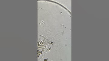 Microorganism under a microscope #short #shortvideo #subscribe #shortsvideo #science