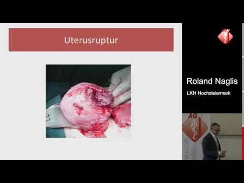 Schwangerschaftskomplikationen - Roland Naglis