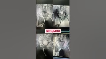 RGU/MCU #radiology #support #viral #xray #suscribe #viralvideo #anatomy #youtubeshort #radiologist